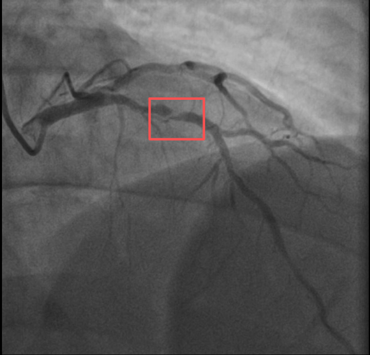 世界杯竞彩-一天内，两位38岁宝爸运动后倒下！其中一位是羽毛球教练