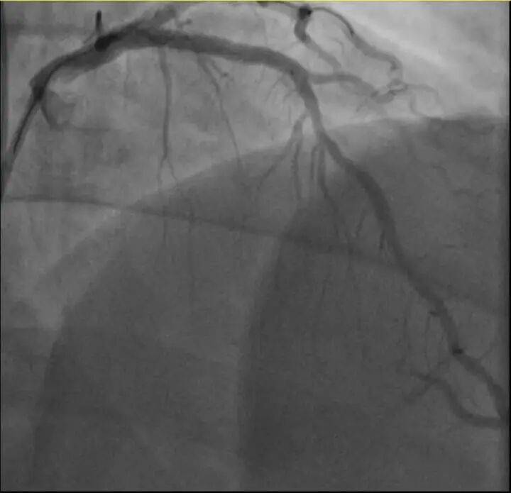 一天内，两位38岁宝爸运动后倒下！其中一位是羽毛球教练